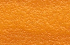 Orange Peel Ceiling Texture